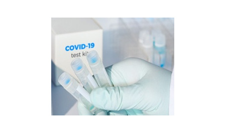 Unveiling of Corona and Type A and B flu virus's detection kits in Arak